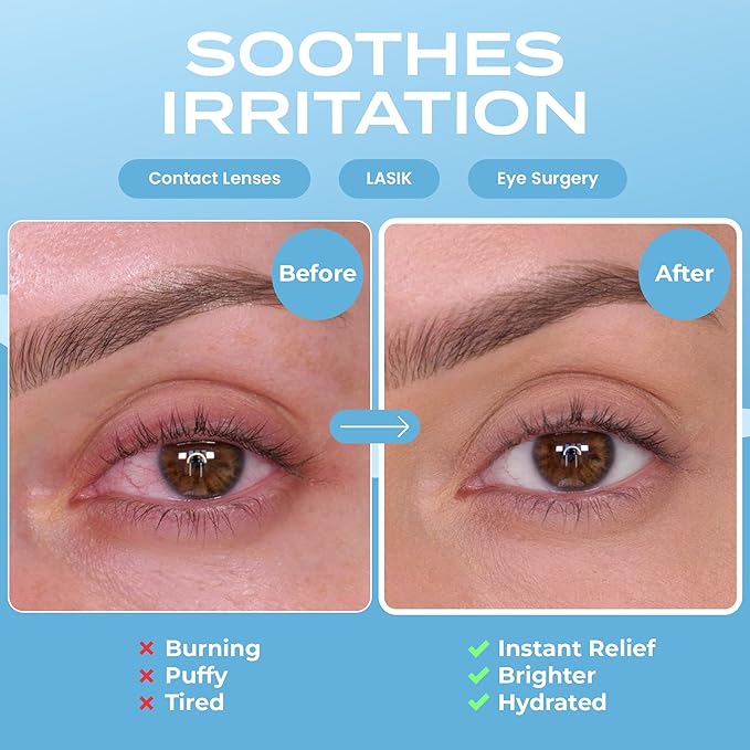 Geurloze Stoom Oogmaskers - 5 Pack