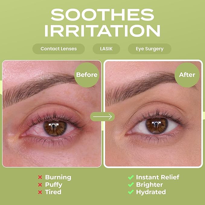 Green Tea Stoom Oogmaskers - 5 Pack